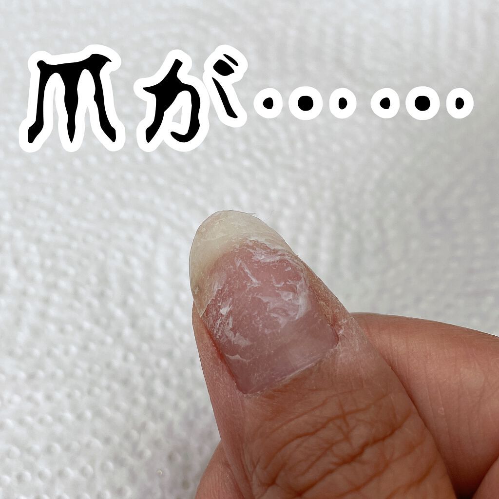 先日浮いてきた爪が髪の毛に引っかかりバチンと取れたのです…
本当痛かった〜😇😇

横のラインの亀裂めちゃくちゃ痛かった🥺

爪の修復技については
今度は動画更新しますね🙋‍♀️

今回は修復からのネイルチェンジです🤣

#ネイル修
