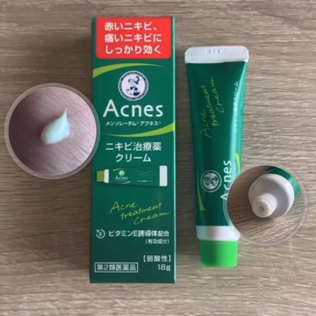 ニキビ治療薬(医薬品)/メンソレータム アクネス/その他の動画クチコミ4つ目