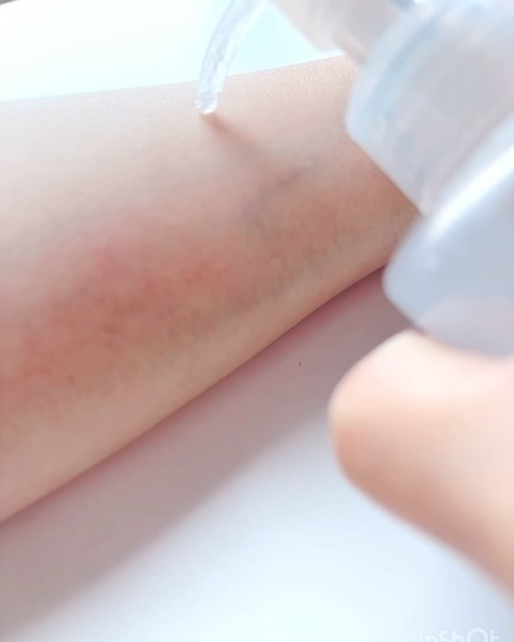 ナチュラルアクアジェル/Cure/ピーリングを使ったクチコミ（2枚目）