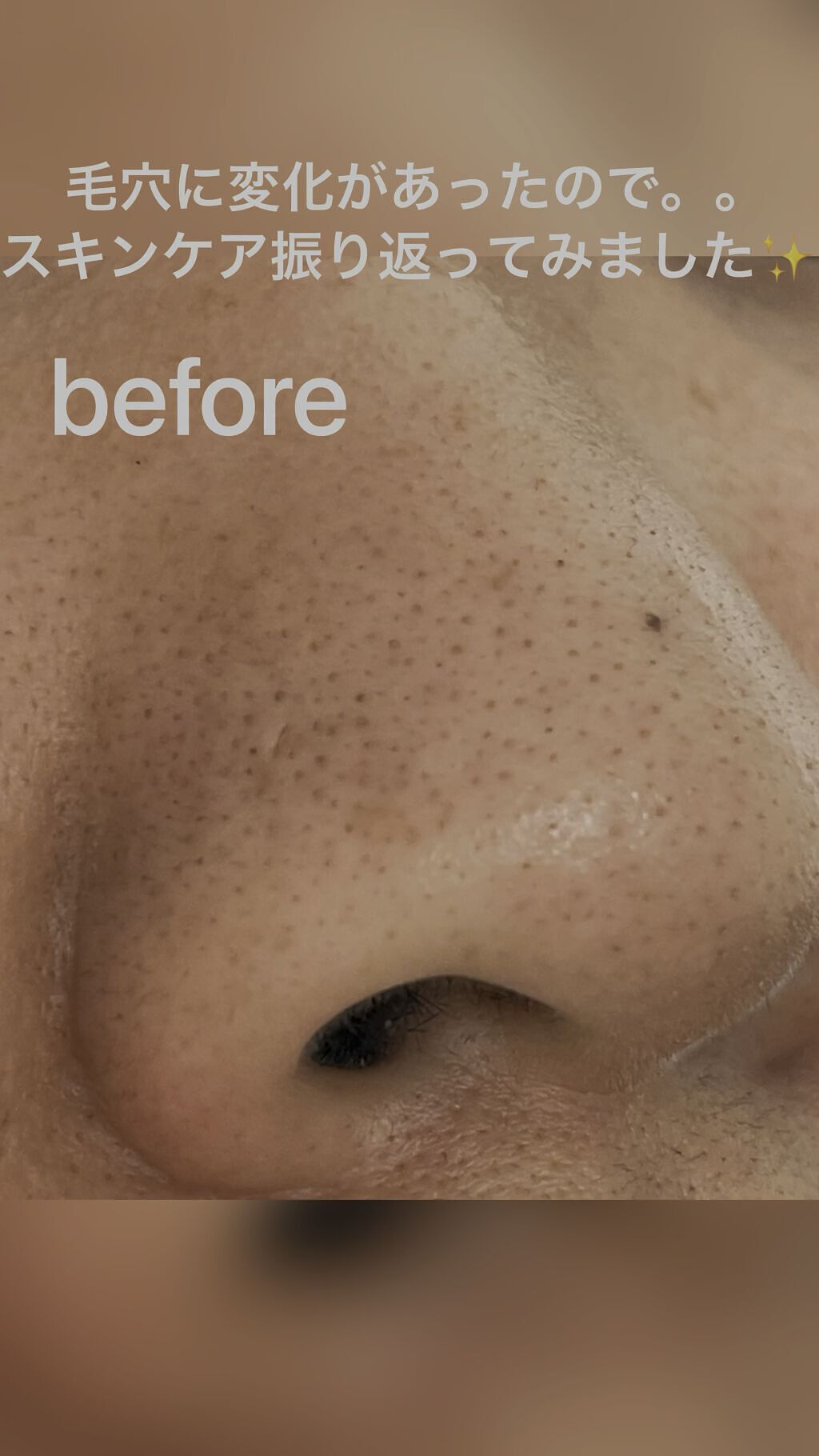 オールナチュラル マスクパックDK/allNATURAL/シートマスク・パックの動画クチコミ1つ目