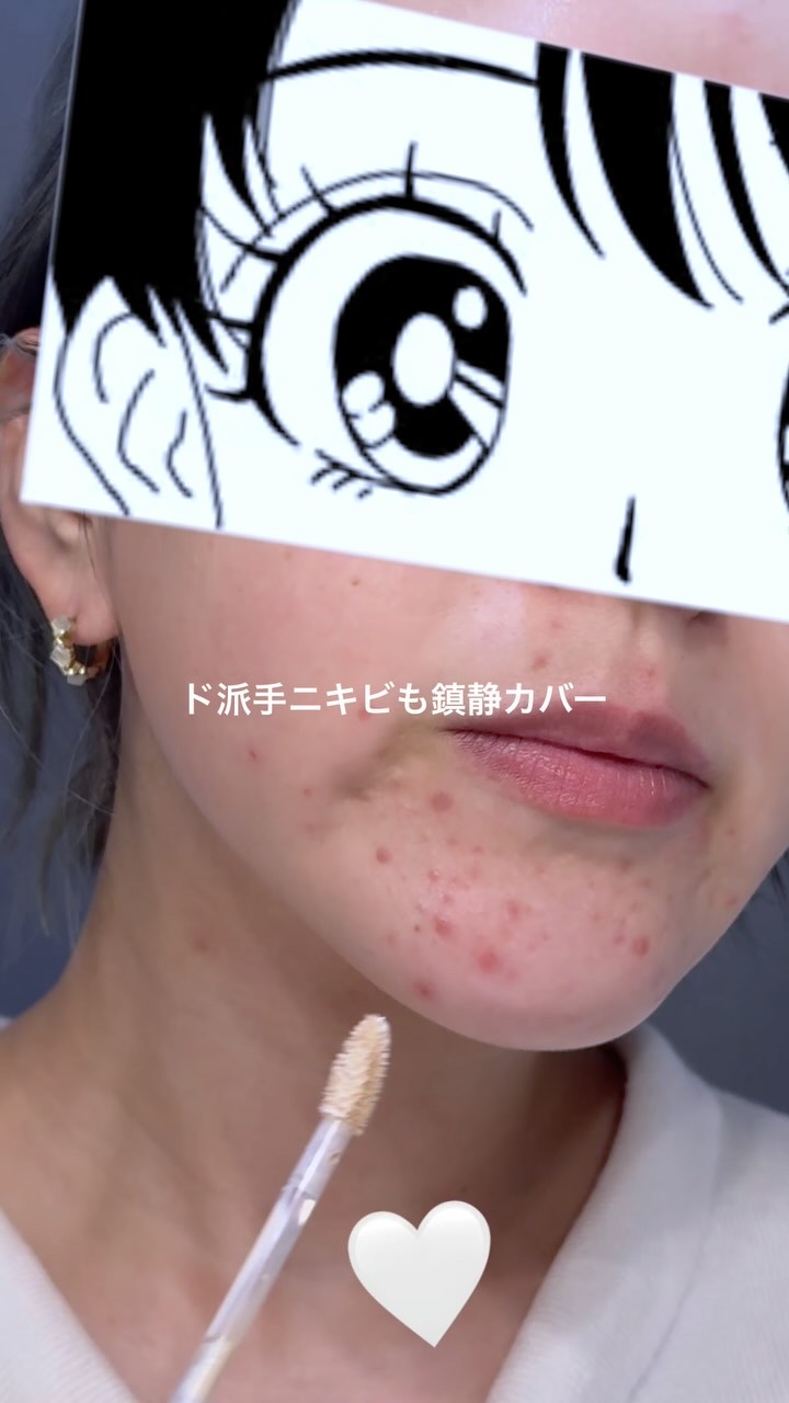 ダーマシンコンシーラー/23years old/リキッドコンシーラーを使ったクチコミ（1枚目）