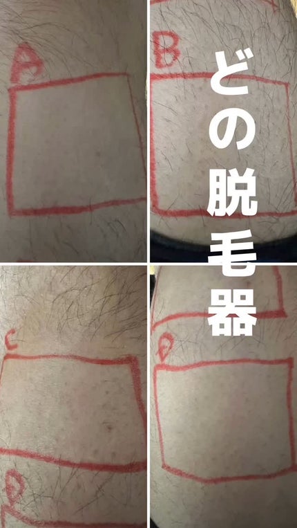 光美容器KE-NON(ケノン) シャインピンク / エムテック(Mteck 光美容器KE-NON(ケノン) シャインピンク / エムテック(Mteck