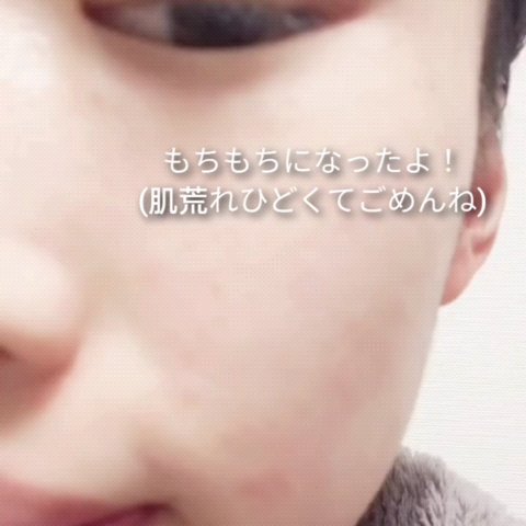 バリアダームデイリーモイストシートマスク/SKIN&LAB/シートマスク・パックの動画クチコミ1つ目