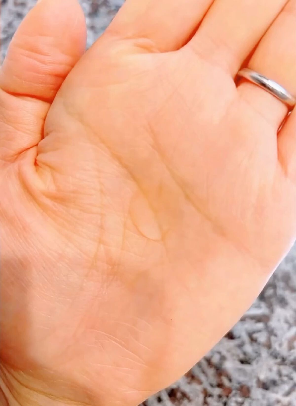 ガラクナイアシン2.0エッセンス/manyo/美容液を使ったクチコミ（3枚目）