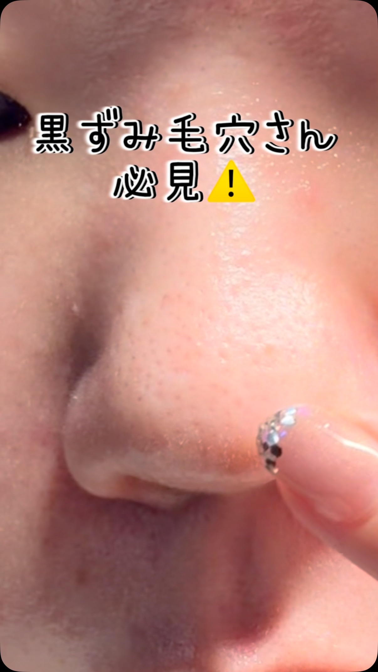 レッドラクトコラーゲンクレンジングオイル/MEDIPEEL/オイルクレンジングの人気ショート動画