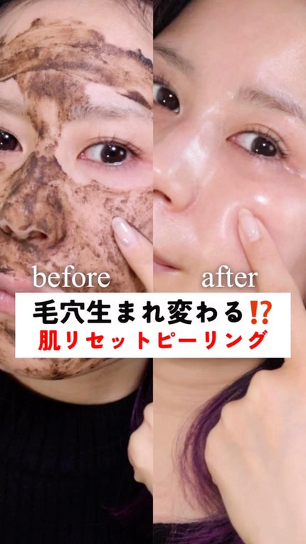 ダーマスキンピーリング/BQCELL/その他キットセットの人気ショート動画