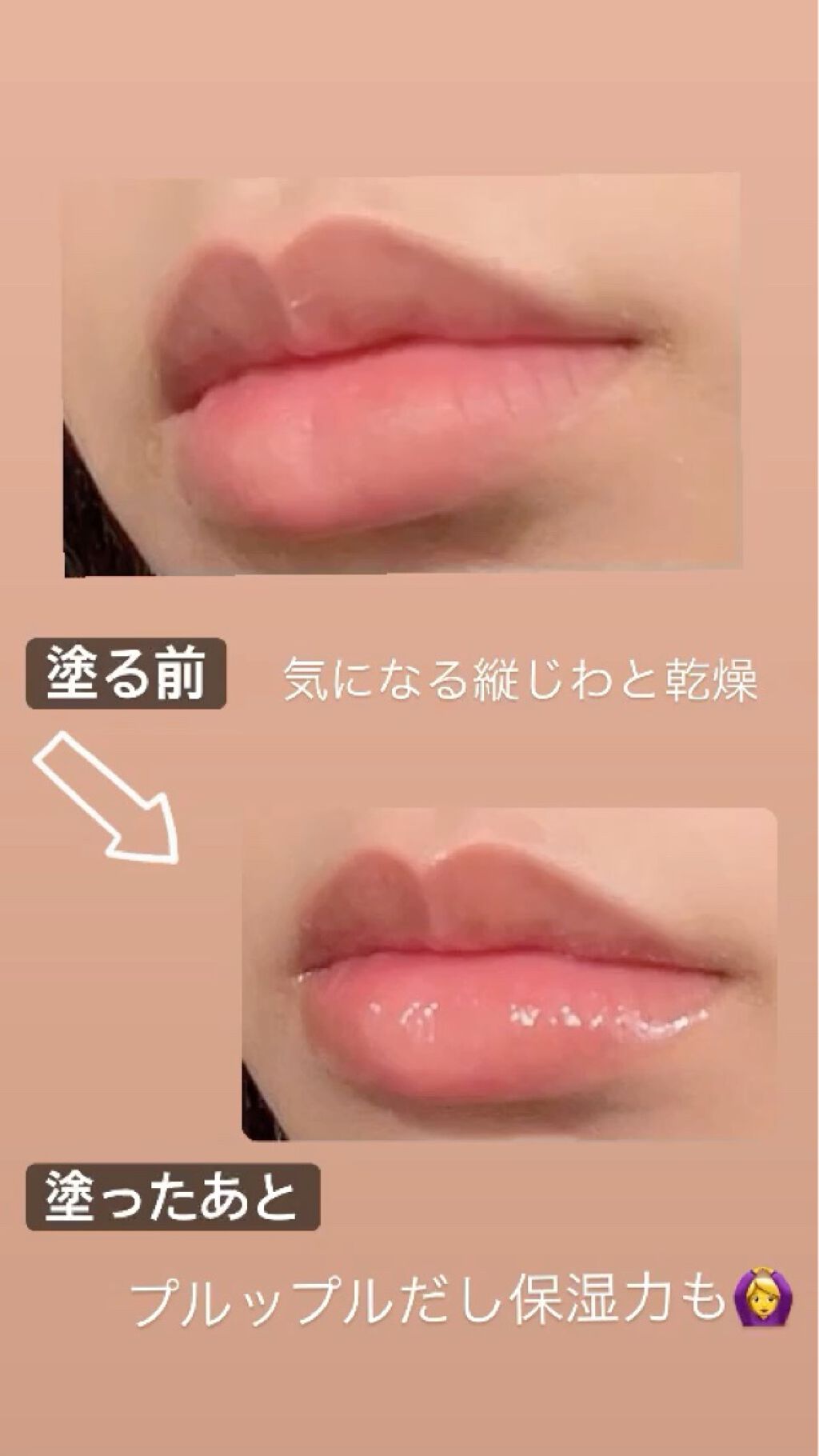 ドトムリッププラスプランパー/keybo/リッププランパーを使ったクチコミ（2枚目）