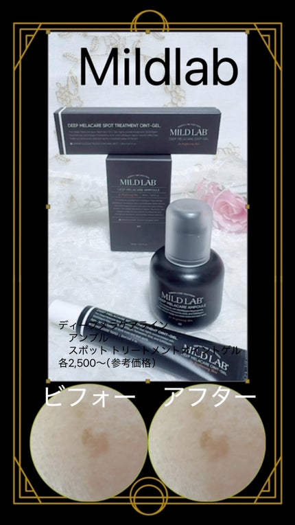 ディープ メラケア 美容液/Mildlab/美容液の人気ショート動画