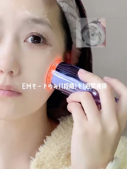 インモトックス小顔リフトアップペプチドショットクリーム&吸引ジェット/MEDITHERAPY/フェイスクリームを使ったクチコミ(3枚目)