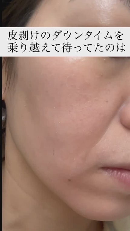 ダーマスキンピーリング/BQCELL/その他キットセットの人気ショート動画