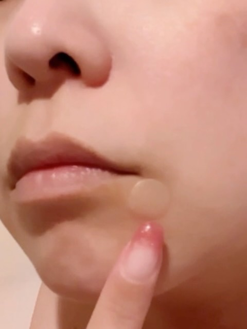 バンドエイド　顔用パッチ/バンドエイド/その他スキンケアの動画クチコミ1つ目