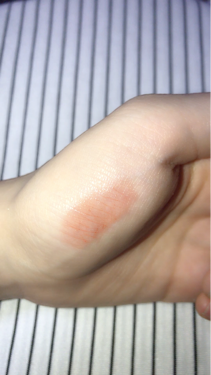 オイルインリップ/セリア/リップグロスを使ったクチコミ(4枚目)