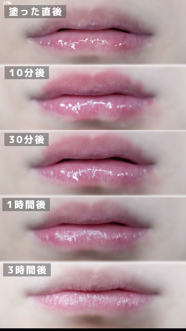 ボリュームリッププランパー/BANILA CO/リッププランパーの人気ショート動画