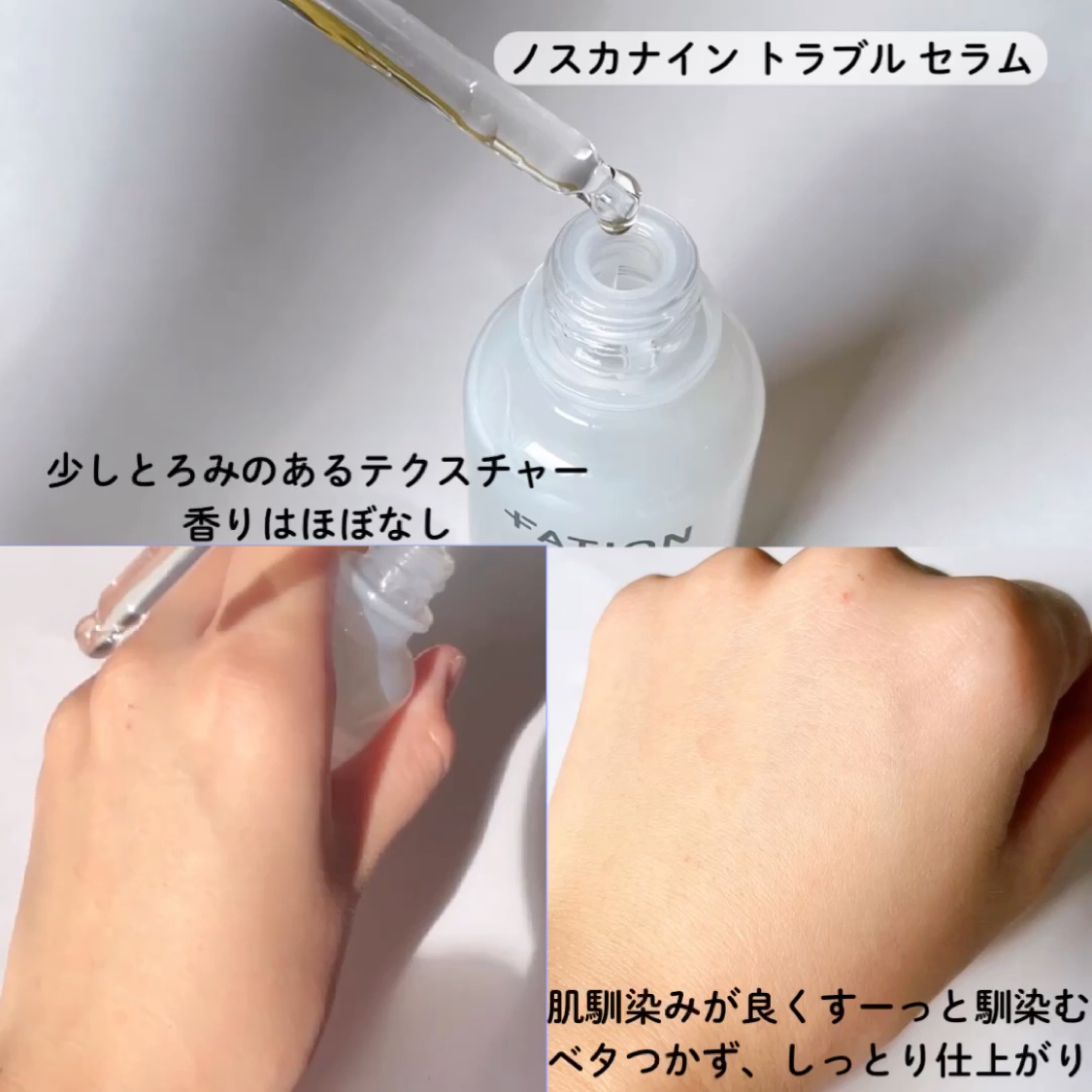 ノスカナイン トラブル セラム/FATION/美容液を使ったクチコミ（3枚目）