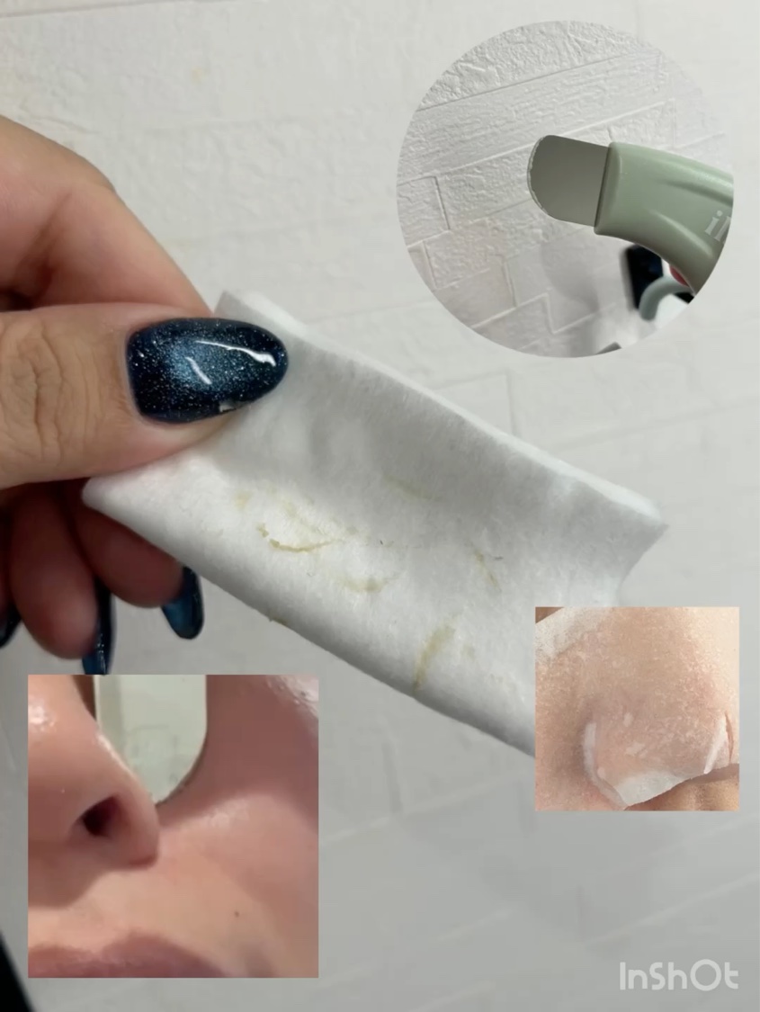 ディープクリーンマスター/ilso/その他スキンケアグッズを使ったクチコミ（3枚目）