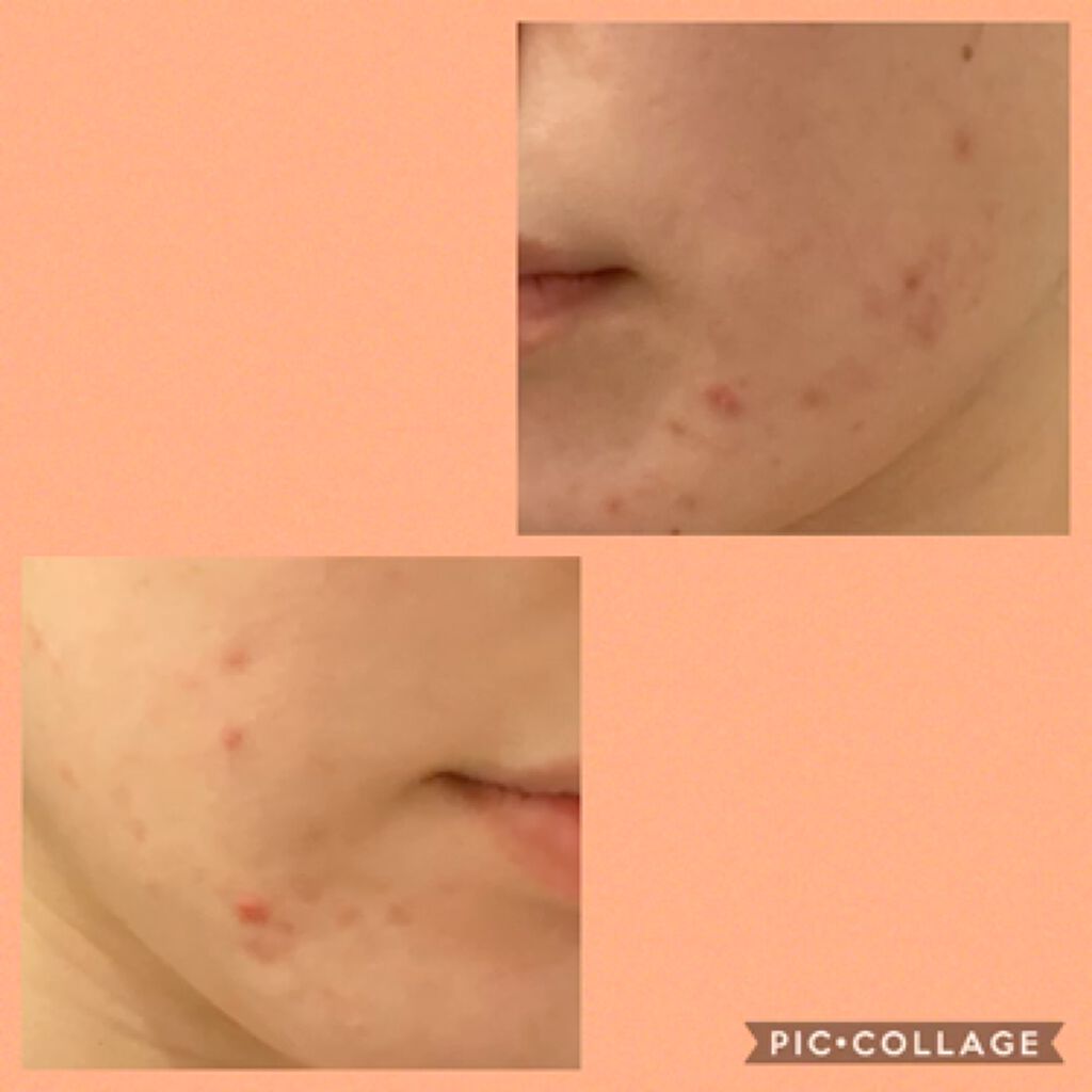 クリアウォッシュ/オルビス/洗顔フォームを使ったクチコミ（1枚目）