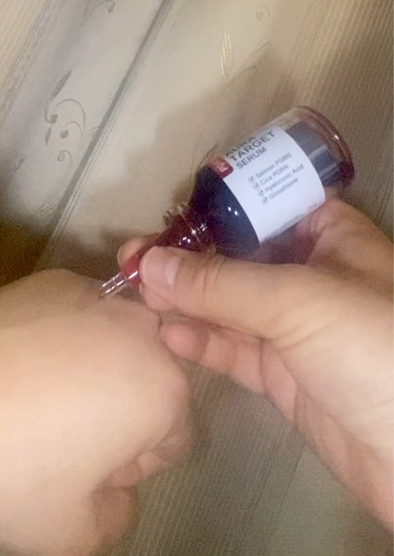 PDRNアルティメットオーラターゲットセラム/SAM'U/美容液を使ったクチコミ（3枚目）