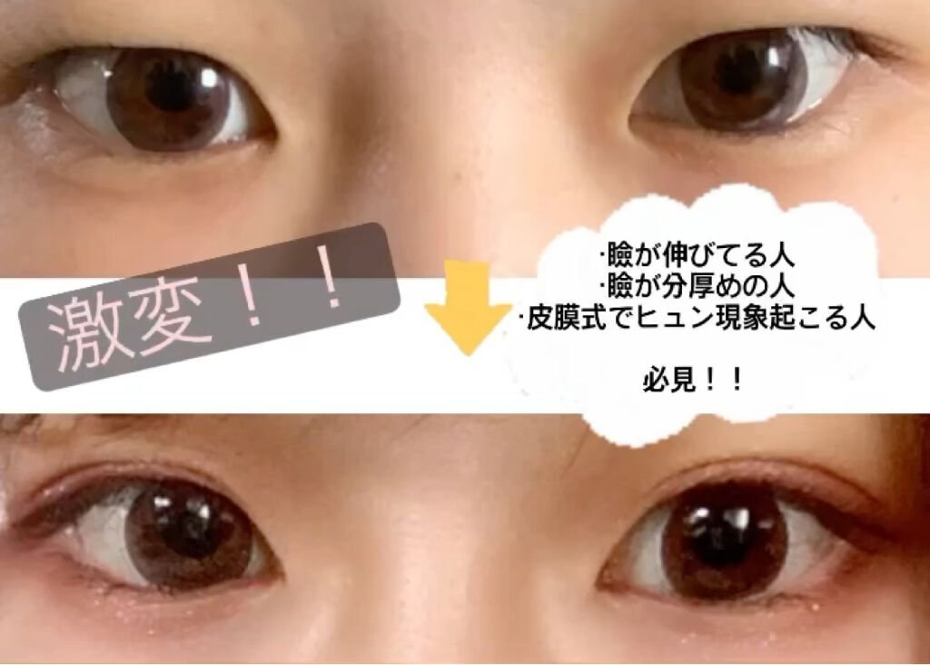 アイビューティー フィクサー WP/アストレア ヴィルゴ/二重まぶた用アイテムを使ったクチコミ（1枚目）