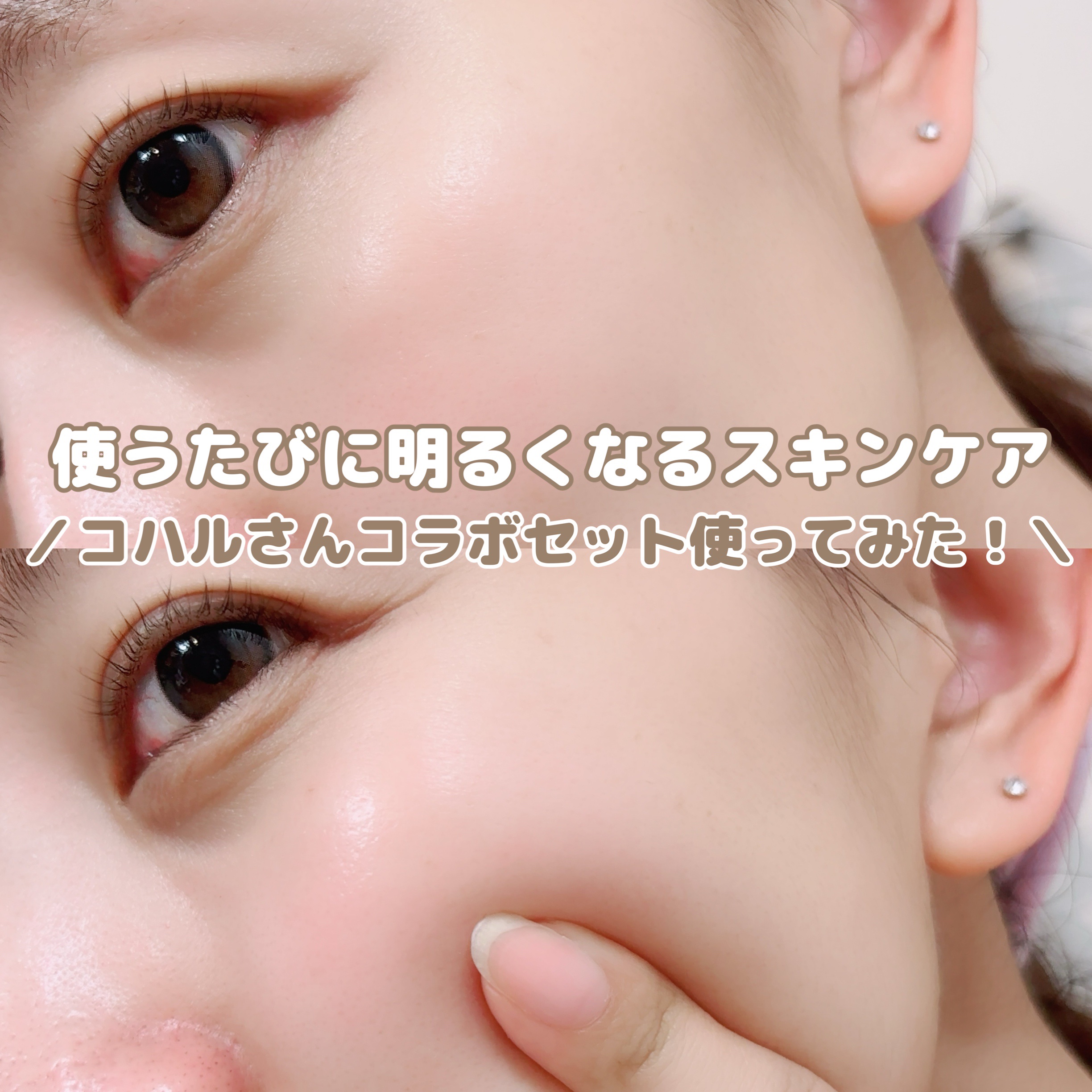 ディープメラケア エンハンスドクリーム/Mildlab/フェイスクリームの動画クチコミ4つ目