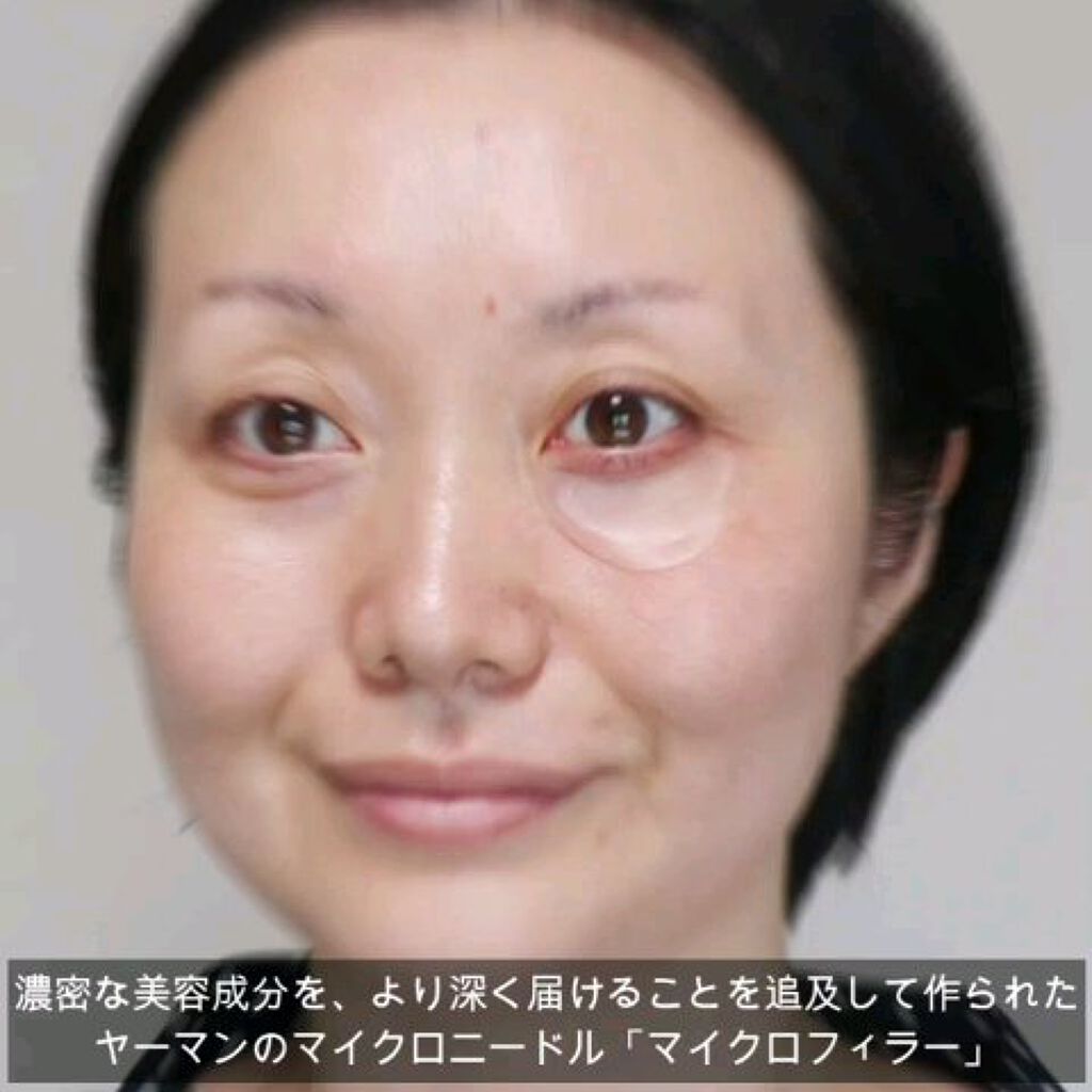 メディリフト 3Dマイクロフィラー(口元用)/YA-MAN TOKYO JAPAN/シートマスク・パックの動画クチコミ5つ目