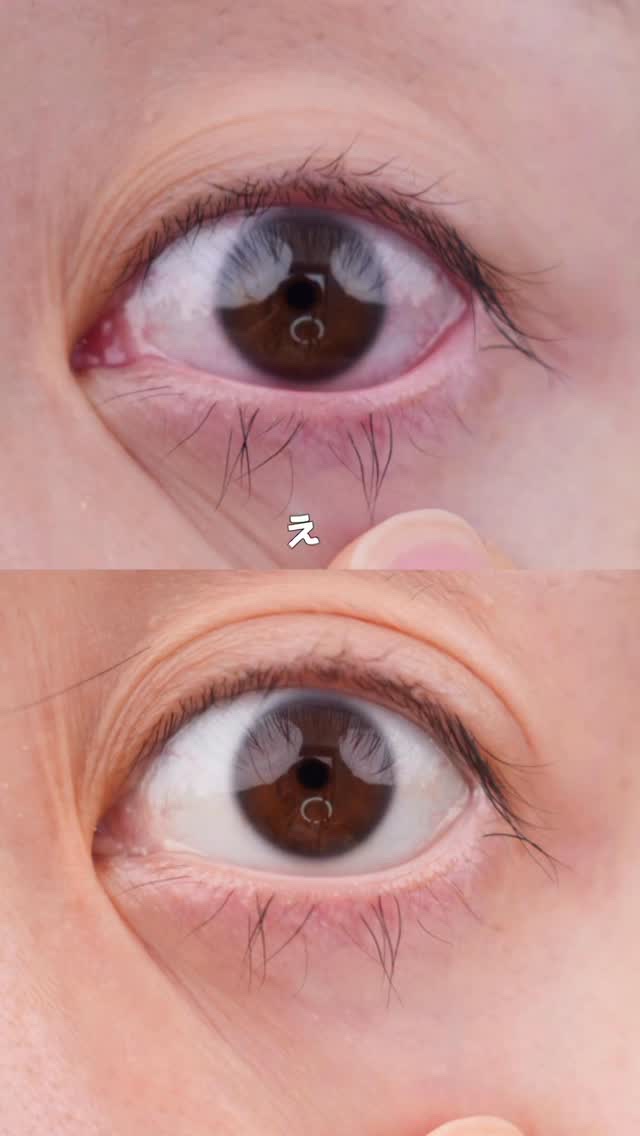 マイティアを使うだけで、顔の盛れ具合がマジで違うので紹介します。

こないだ自分のブランドの撮影をしたんだけど…
目が赤くて、顔全体の疲労感すごかった😢

最近、動画の撮影前にもマイティアをよく使うんだけど…
自分で充血してないな…と感じ