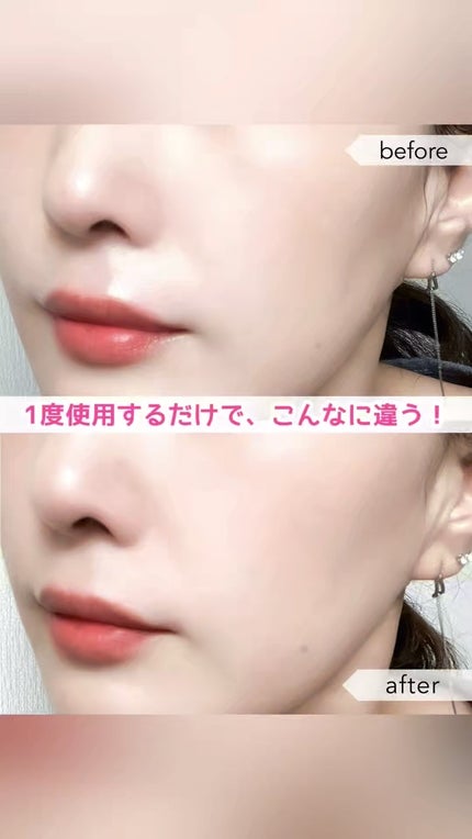 レッドモチセラム30/アレンシア/美容液の人気ショート動画