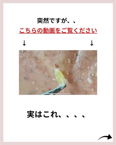 あなたの肌に合ったスキンケア💐コーくん on LIPS 「【知らないとマジで損】エグいほど鼻の角栓が消える方法..あなた..」（2枚目）