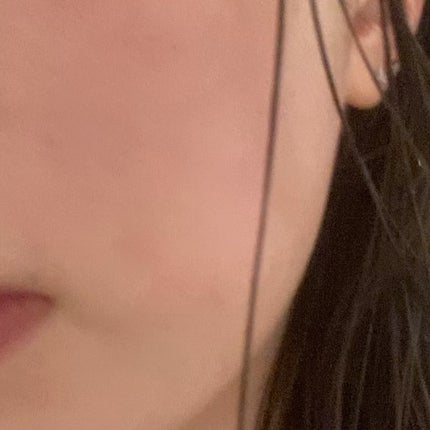 レッドブレミッシュ クリアスージングクリーム/Dr.G/フェイスクリームを使ったクチコミ(4枚目)