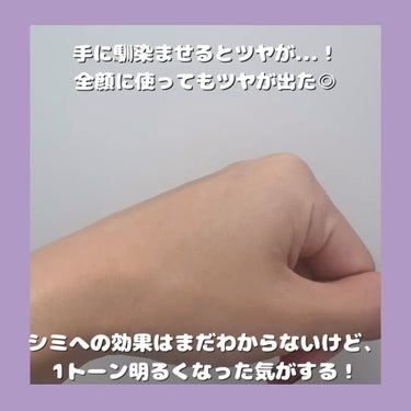 Glutacica Melasma Cream/Dr.Viuum/その他スキンケアを使ったクチコミ（3枚目）