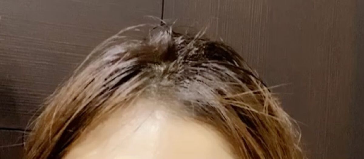 薬用頭皮ケアトニックD/日本ライフ製薬/頭皮ローションの動画クチコミ1つ目