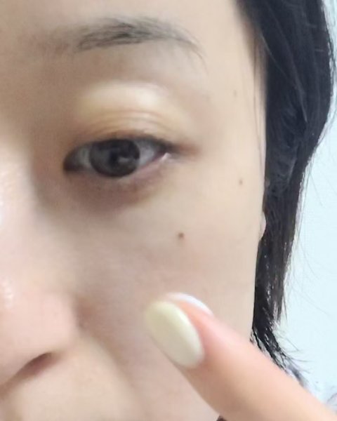 ラグジュアリー薬用NAリンクルクリーム/demarrer/アイケア・アイクリームの動画クチコミ1つ目