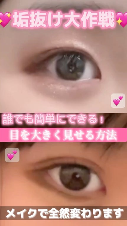 のびーるアイテープ(絆創膏タイプ、レギュラー)/DAISO/二重まぶた用アイテムの人気ショート動画