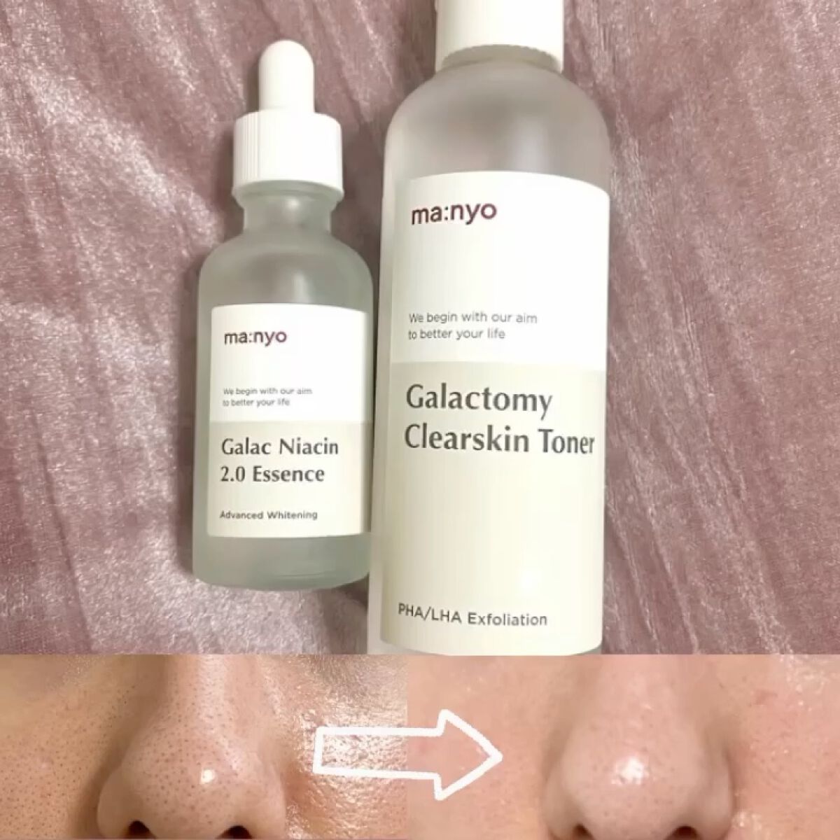 ガラクトミー スキントナー/manyo/化粧水を使ったクチコミ（1枚目）