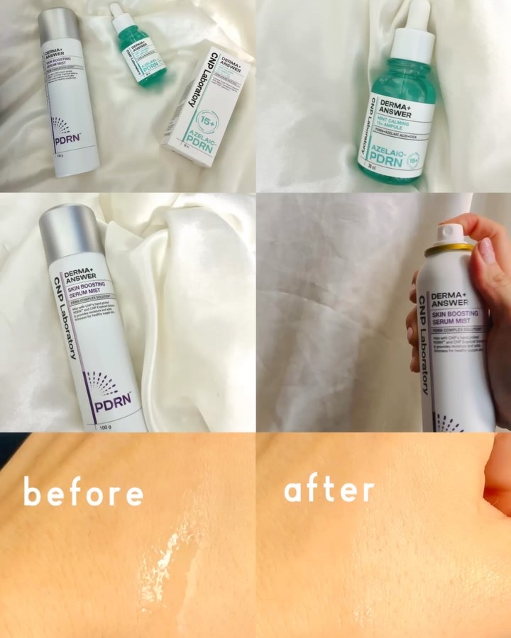 ダーマアンサーアゼライン酸ミントアンプル/CNP Laboratory/美容液を使ったクチコミ（2枚目）