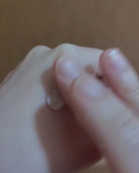 アネトス アクネケア トリートメント セラム/Anetos/美容液を使ったクチコミ（3枚目）