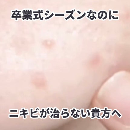 ポイントパッチ(集中ケアシート) 60枚入り / アクネスラボ(ACNES ポイントパッチ(集中ケアシート) 60枚入り / アクネスラボ(ACNES