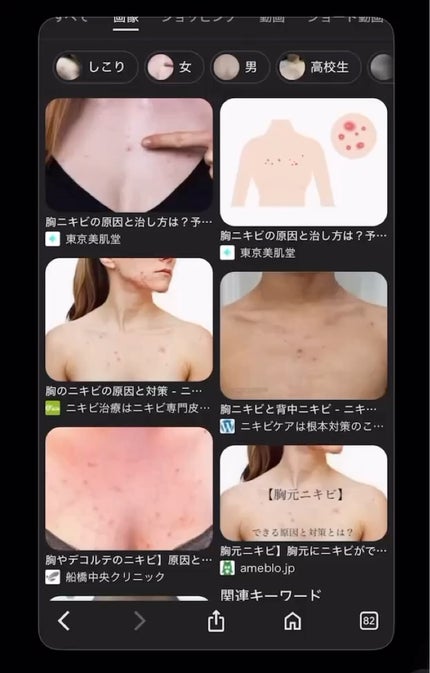 セナキュア(医薬品)/小林製薬/その他の人気ショート動画