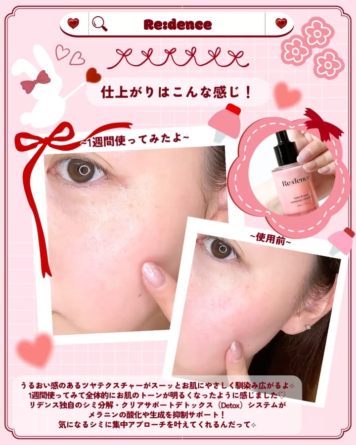 リデンス チェリートーン＆スポットコレクターアンプル/redence/美容液を使ったクチコミ（3枚目）