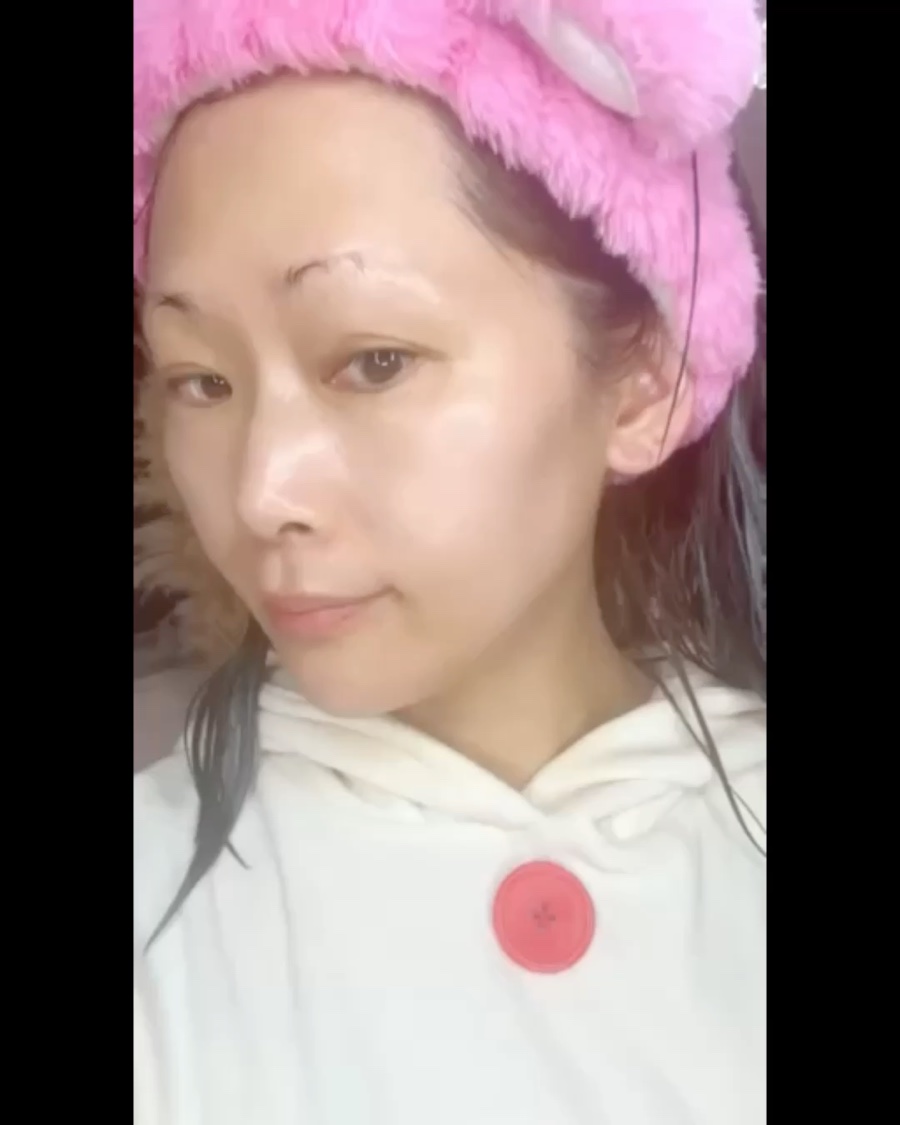 リンクルトックス5Dショット/cellinto/アイケア・アイクリームを使ったクチコミ（1枚目）