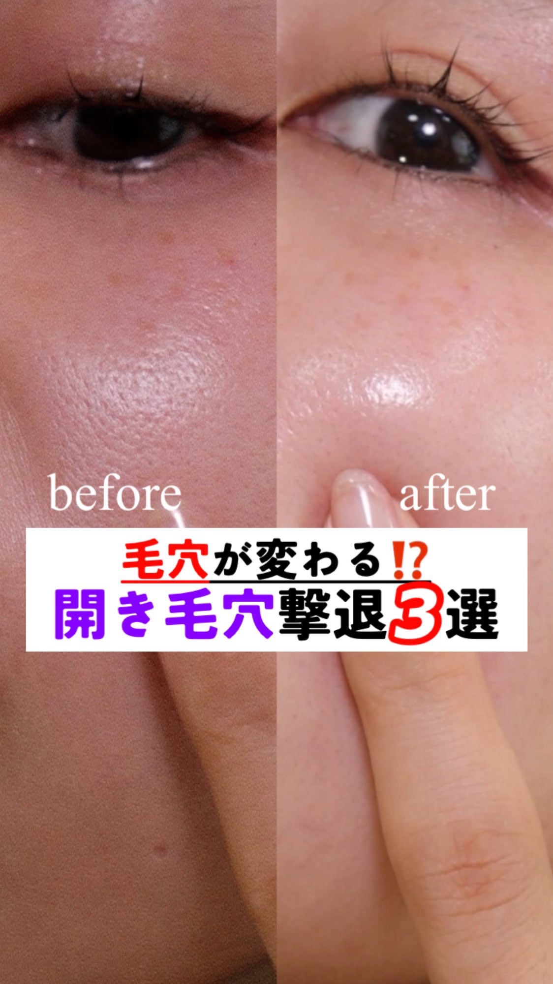 前回保存数が多かった“毛穴に効く成分まとめ”のパート2！

今回の3つは、大人は特に知らんまま過ごすにはもったいないやつ。
✔ アゼライン酸
✔ ビタミンC誘導体
✔ PDRN

大人肌はこのへん使いこなしてなんぼやで。
保存して、毛穴ケア