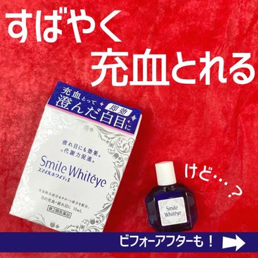 スマイルホワイティエ(医薬品)/ライオン/その他を使ったクチコミ（1枚目）