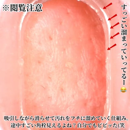 アレティ ポアスコープ/Areti./美顔器・マッサージを使ったクチコミ(7枚目)