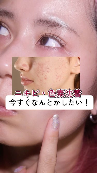 ニキビのしきちんまでケアできるパッドあるの知ってた〜？？
medicubeレッドアクネシリーズから新しく出たレッドアクネピーリングパッドめっちゃ良かった〜！

普段あんまりニキビないから、ニキビケアって