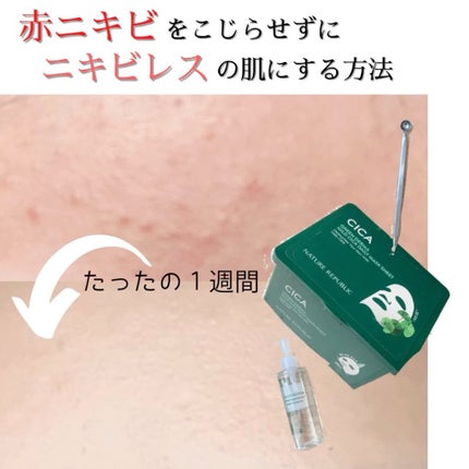 ポアヌーク ザ・ポアクリアスティック/STYLE+NOBLE/その他スキンケアグッズを使ったクチコミ(1枚目)