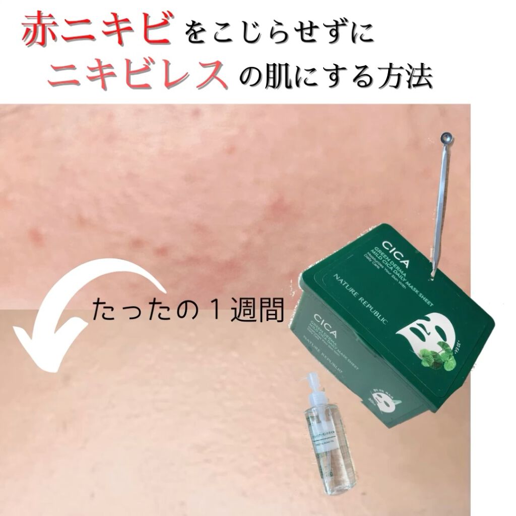 グリーンダーマCICA デイリーシートマスク/ネイチャーリパブリック/シートマスク・パックを使ったクチコミ（1枚目）