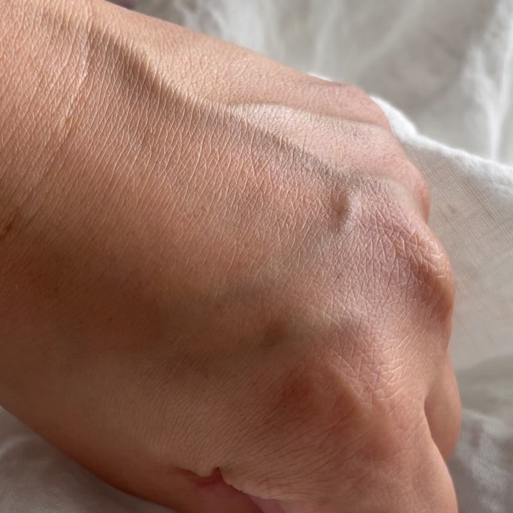 15%ナイアシンアミドピュアリティセラム/Dr.Althea/美容液を使ったクチコミ（2枚目）