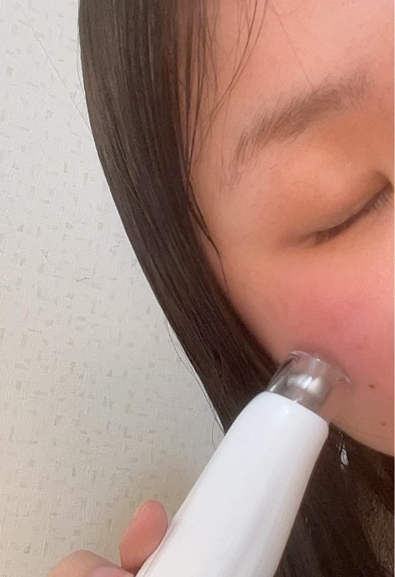 エッセンシエルポテンセル/essenciel/美顔器・マッサージを使ったクチコミ（2枚目）