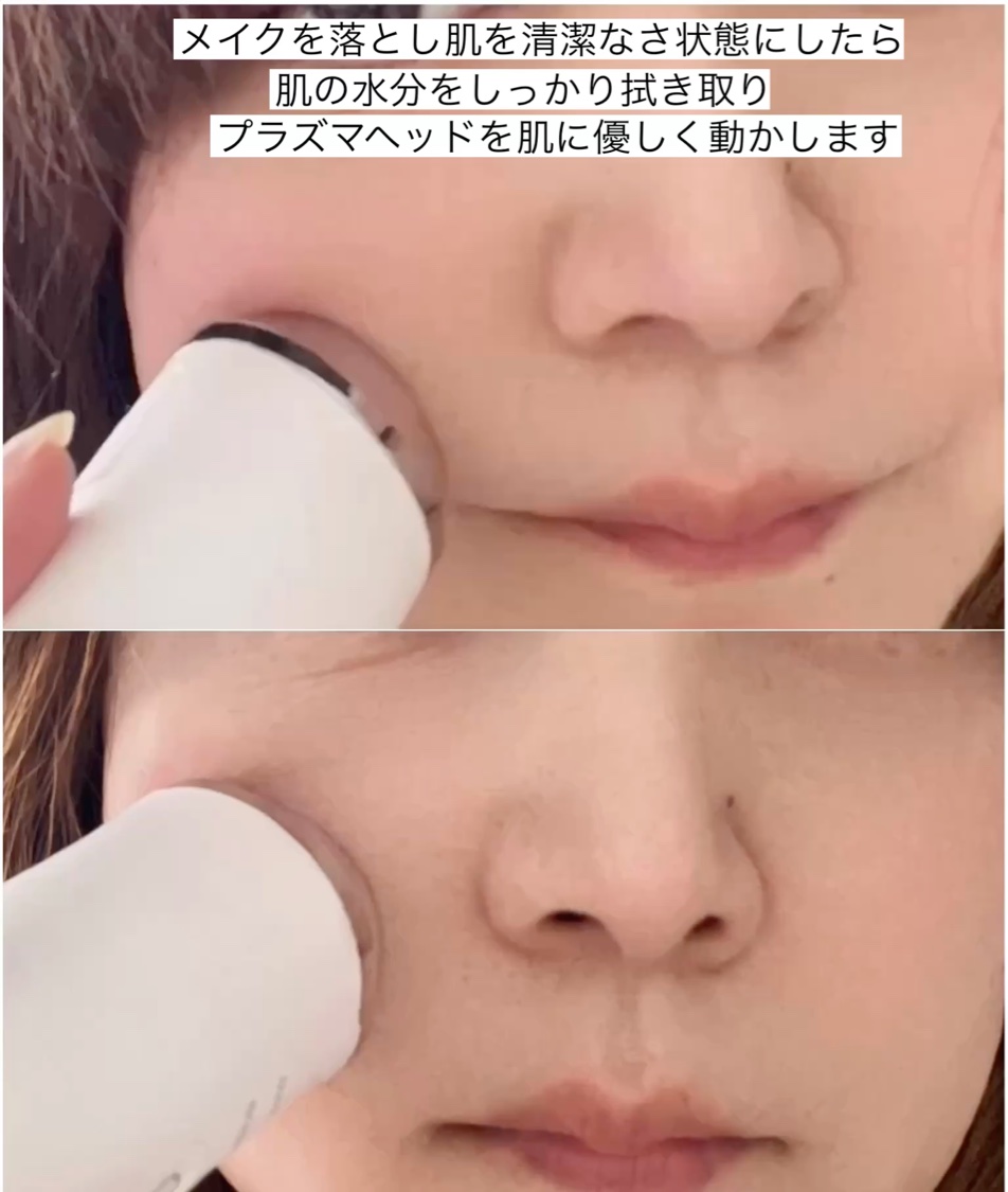 プラズマショットブースター/manyo/美顔器・マッサージを使ったクチコミ（3枚目）