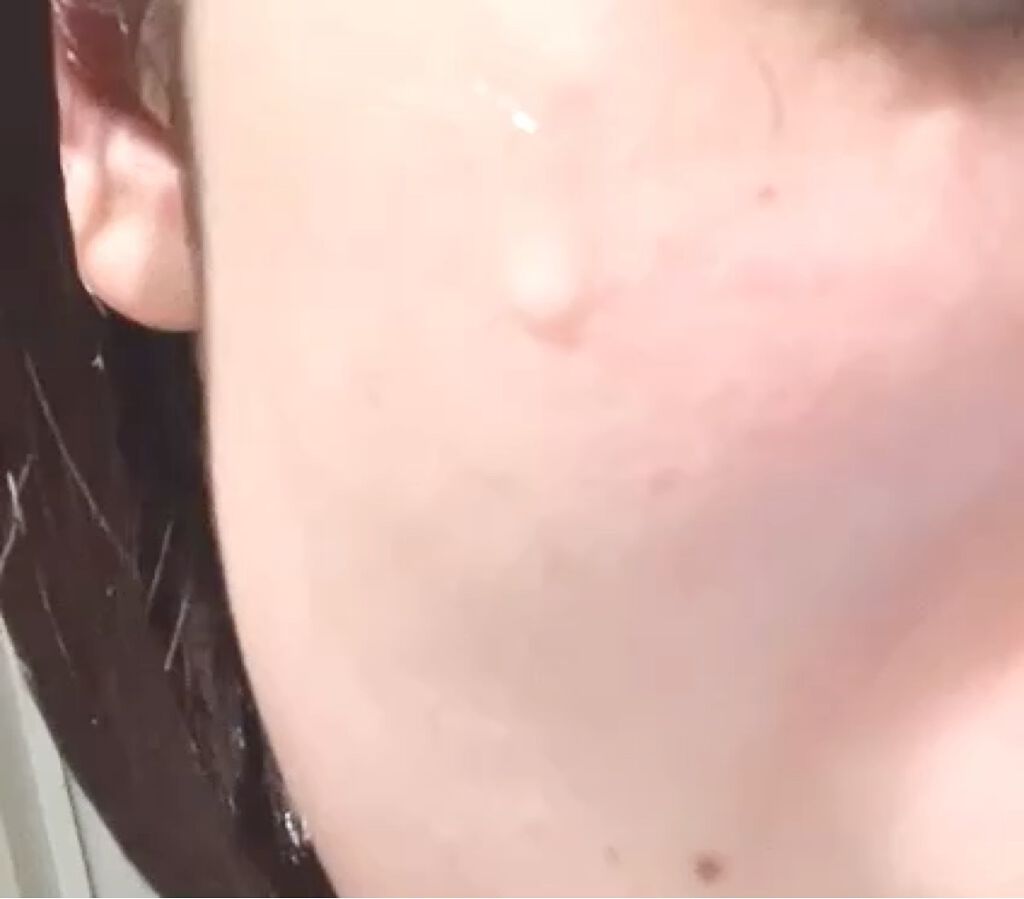 イーブン ベター ラディカル ブライト セラム/CLINIQUE/美容液を使ったクチコミ（3枚目）