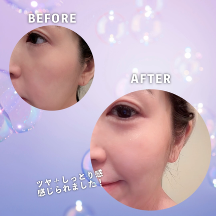 ポアタイトニングトナーパッド/REJURAN COSMETICS/トナーパッドを使ったクチコミ(2枚目)